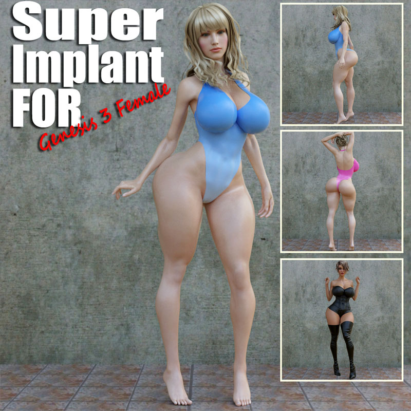 Super Implant For G3F