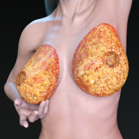 Skinless breast + No nipple Bundle