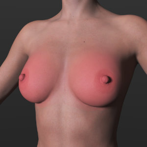Red Breasts G9