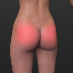 Spanking Marks G9