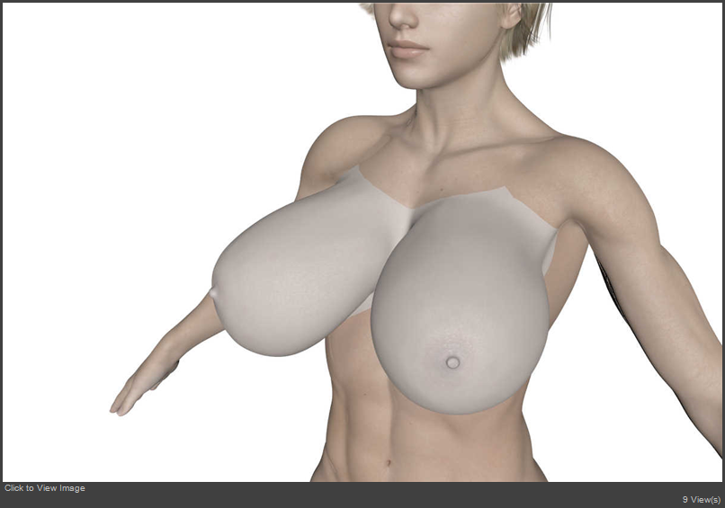 breast1.jpg