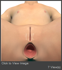 LaFemme2 DL lip tuck anal impos1.png