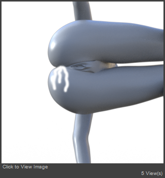 On the Side 1.png
