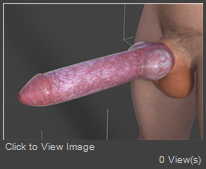 LL.jpg