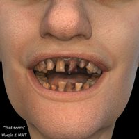 Henrika_ChrissyBundleforG9_ChrissyBadTeeth-(1).jpg