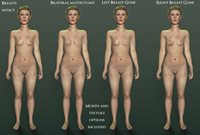 Henrika_Carcinoma_MorphAlternatives.jpg